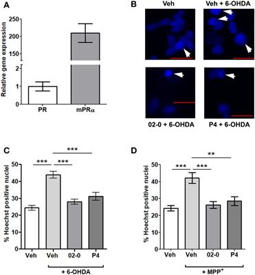 Progesterone exerts a neuroprotective action in a Parkinson’s disease human cell model through membrane progesterone receptor α (mPRα/PAQR7)